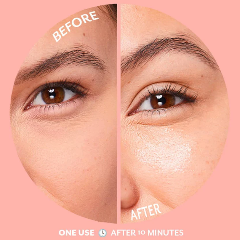 UNDEREYE Bubbly Brightening Eye Gels Under Eye Patches