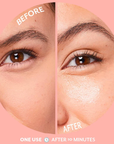 UNDEREYE Bubbly Brightening Eye Gels Under Eye Patches
